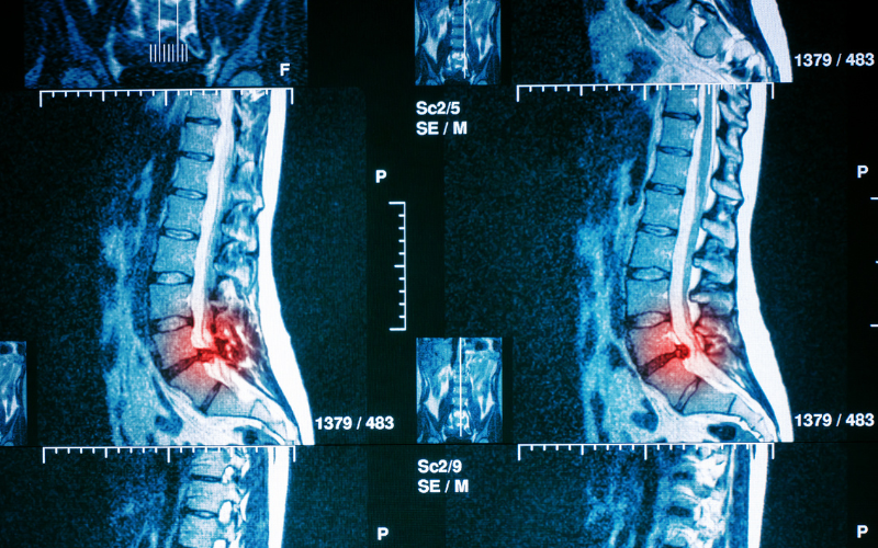 MRI גבי